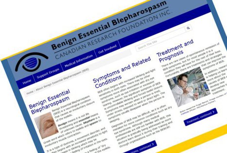 screen capture of blepharospasm.ca homepage